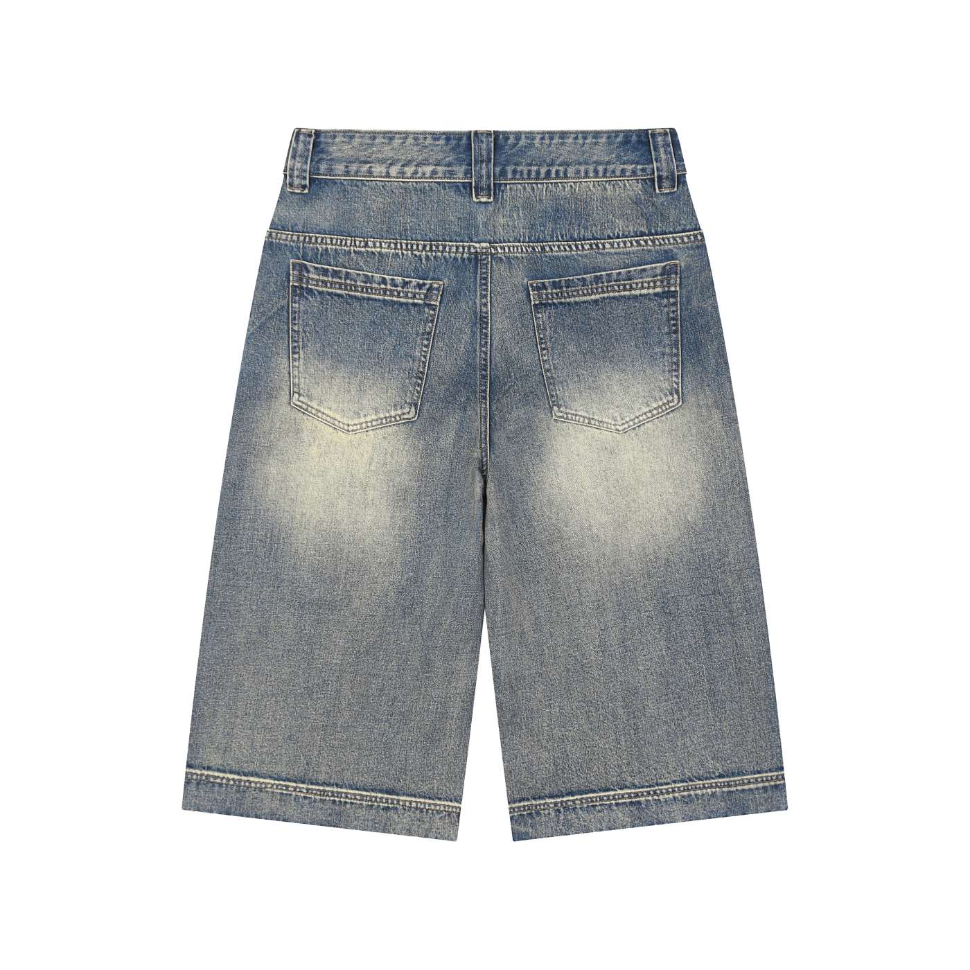 Jorts Calle